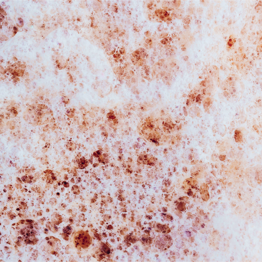 Close-up of foamy protein surface with white and reddish-brown bubbles and dense cellular texture.
